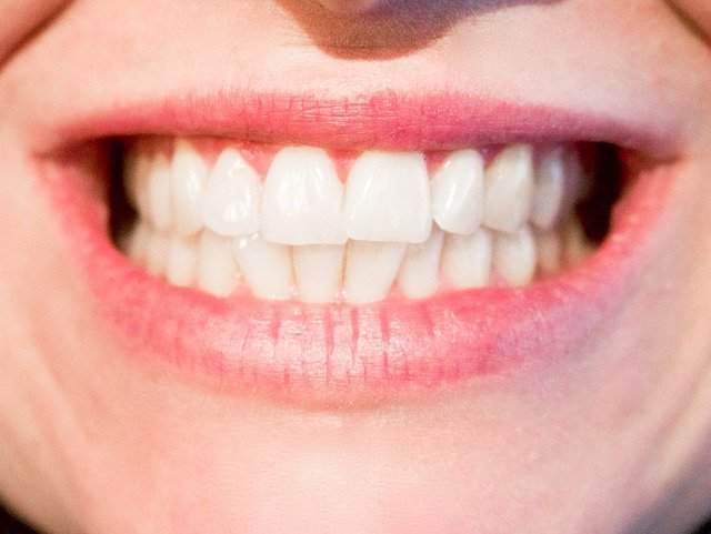 how to whiten teeth naturally